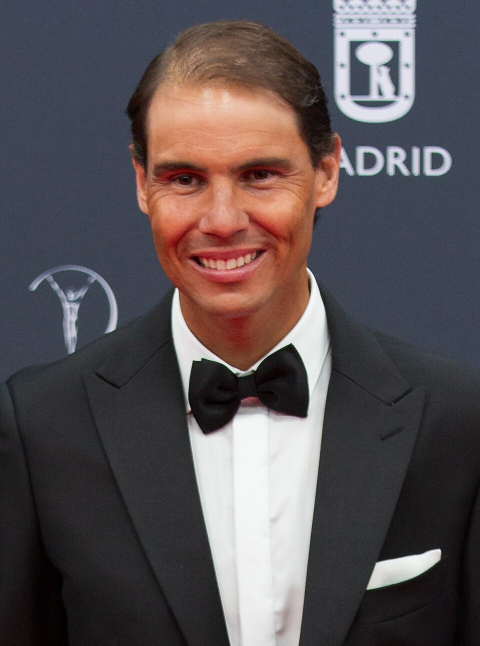 rafael-nadal-haartransplantation-was-ist-uber-seinen-haarausfall-bekannt.jpg