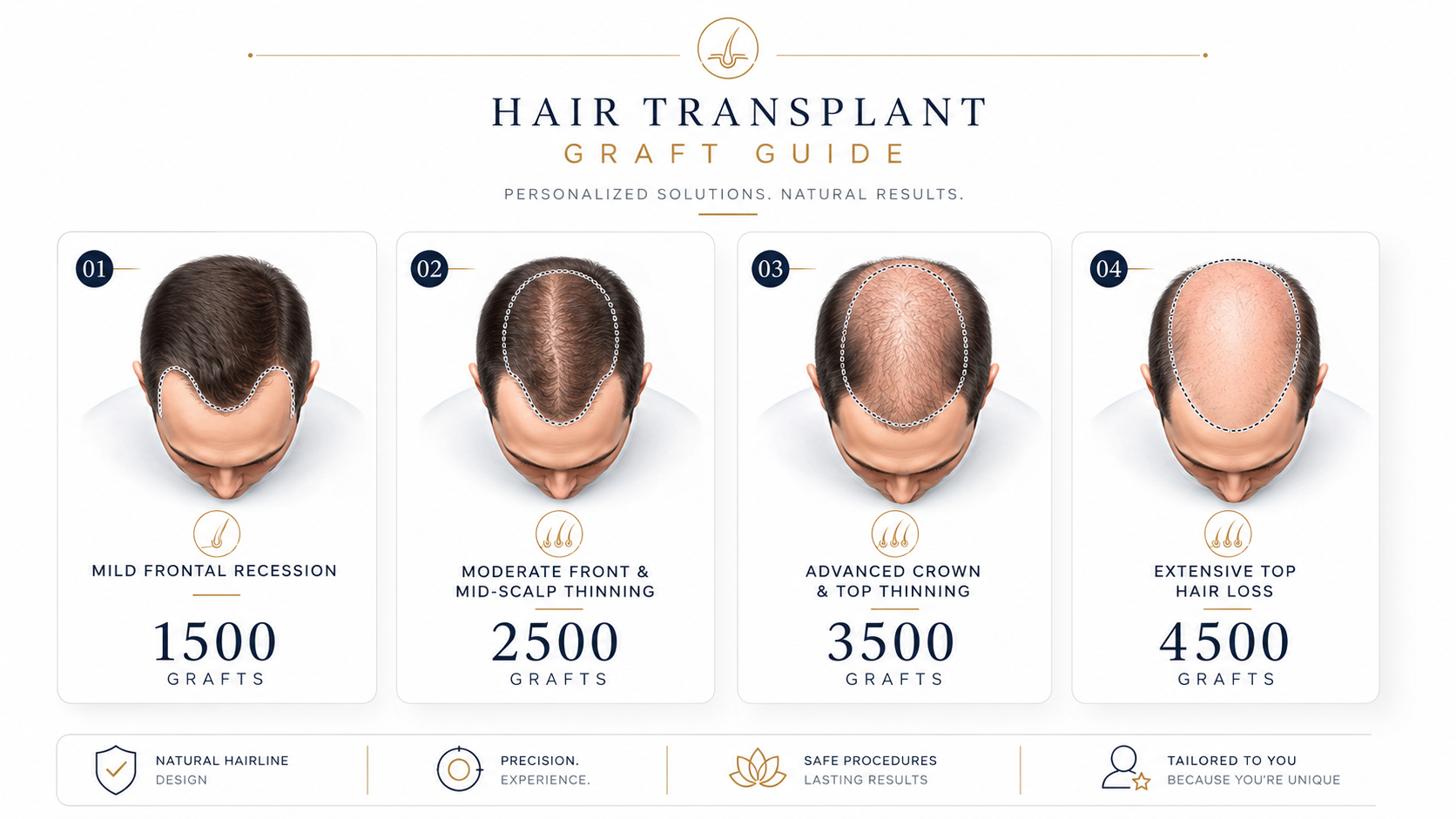 Wie viele Grafts brauche ich?