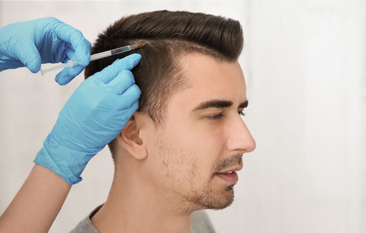 Ist eine Haartransplantation schmerzhaft? Ablauf und Erfahrungen