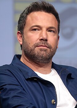 ben-affleck-hair-transplant.jpg