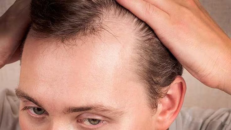 finasteride-and-minoxidil-side-effects.jpg