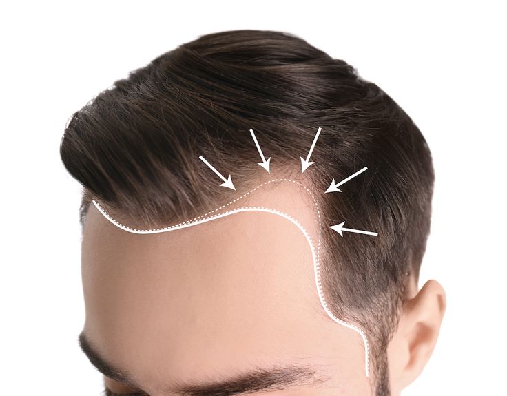 how-many-hairs-are-on-the-average-human-head.jpg
