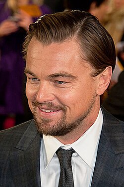 leonardo-dicaprio-hair-transplant.jpg