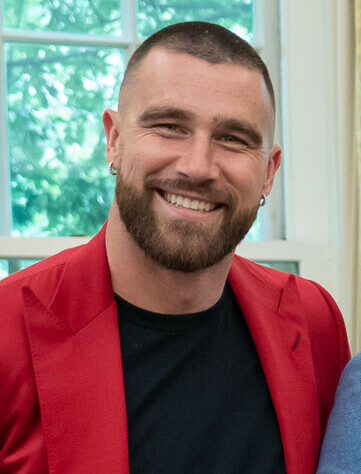 travis-kelce-hair-transplant.jpg