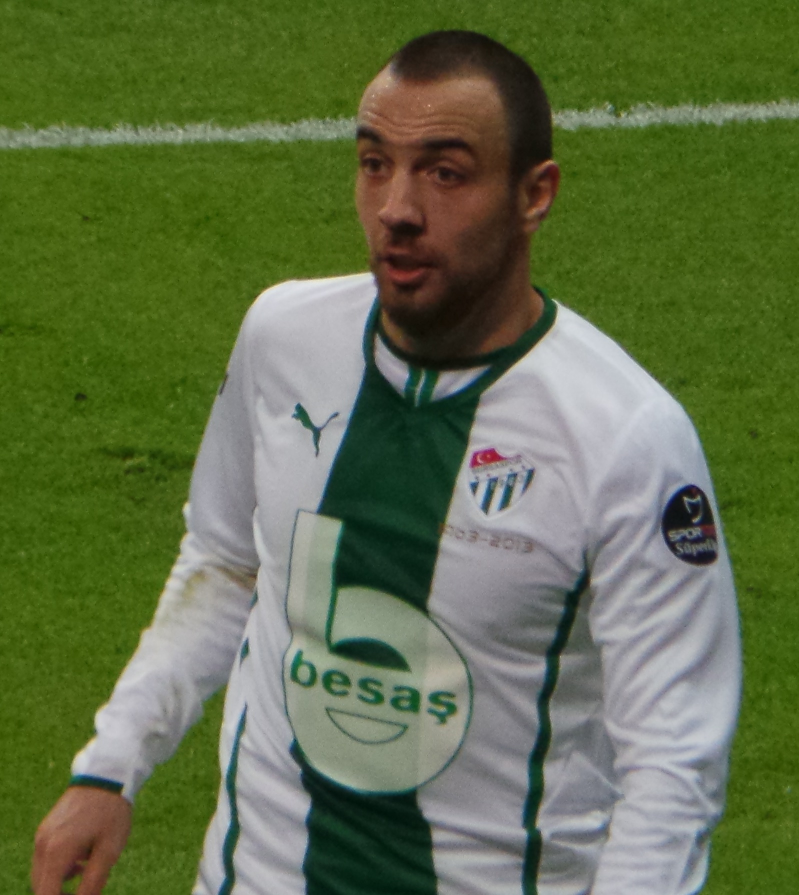 Sercan Yıldırım Saç Ekimi: Maliyet, Öncesi & Sonrası