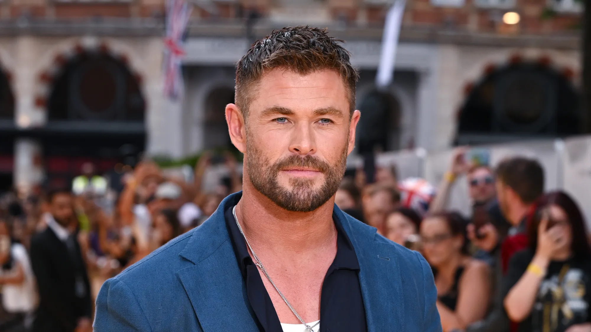 Chris Hemsworth Hairline: Before and After, Transplant Rumors & Expert Analysis