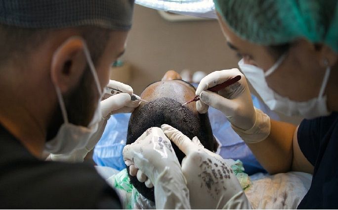 Hair Transplant Financing Options: Best Plans, Loans & Payment Methods (2026 Complete Guide)