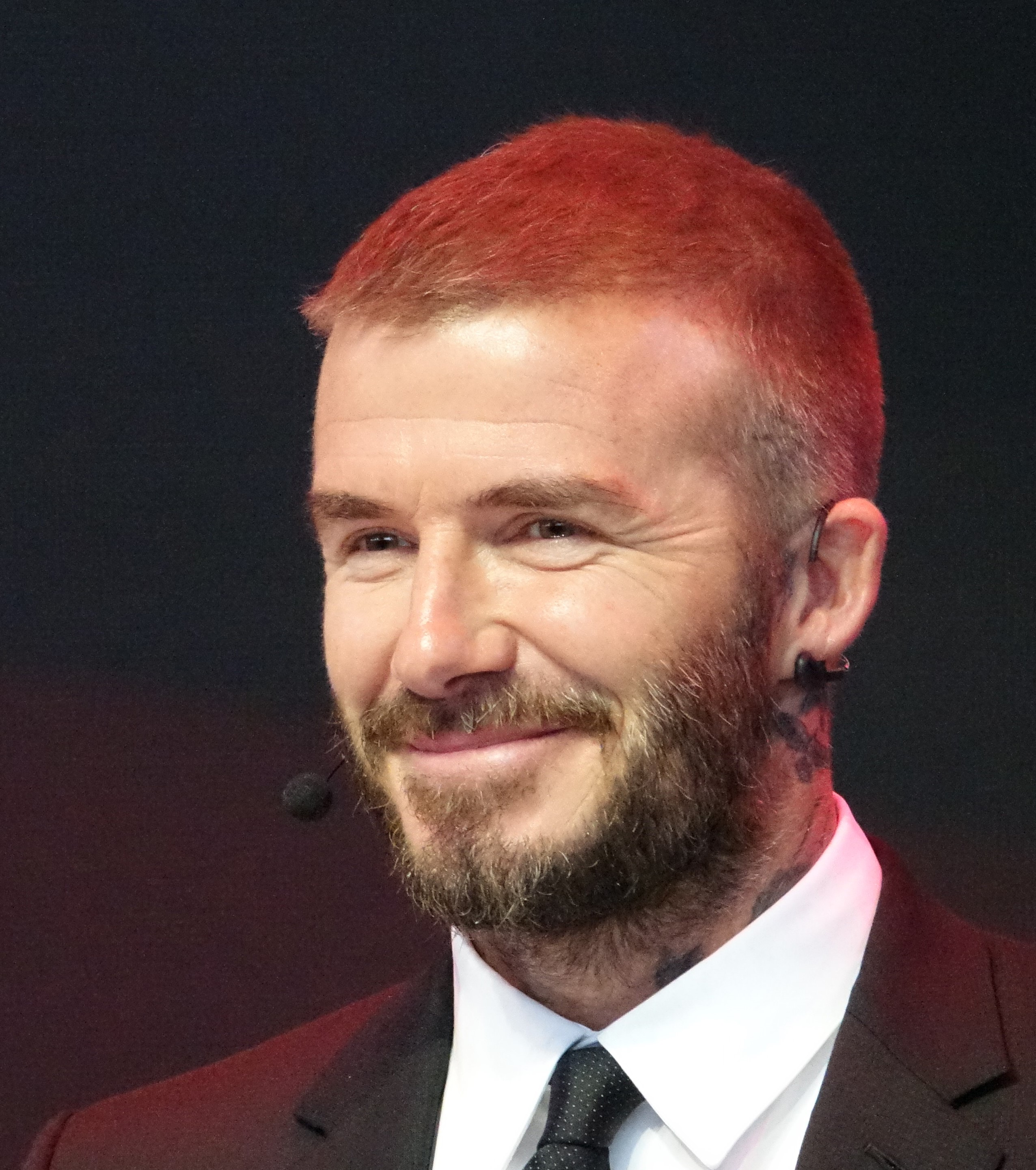David Beckham Hair Transplant