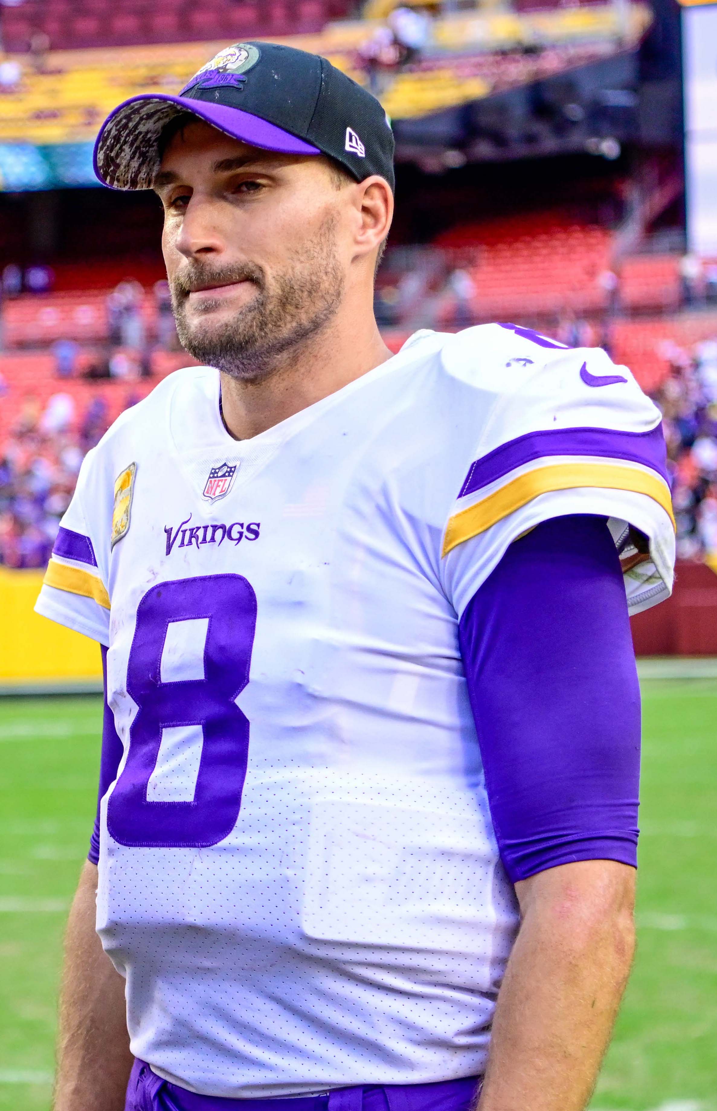 Kirk Cousins Hair Transplant