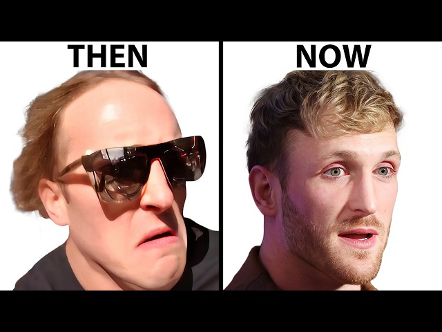 Logan Paul Hair Transplant: Fans Noticed This Change