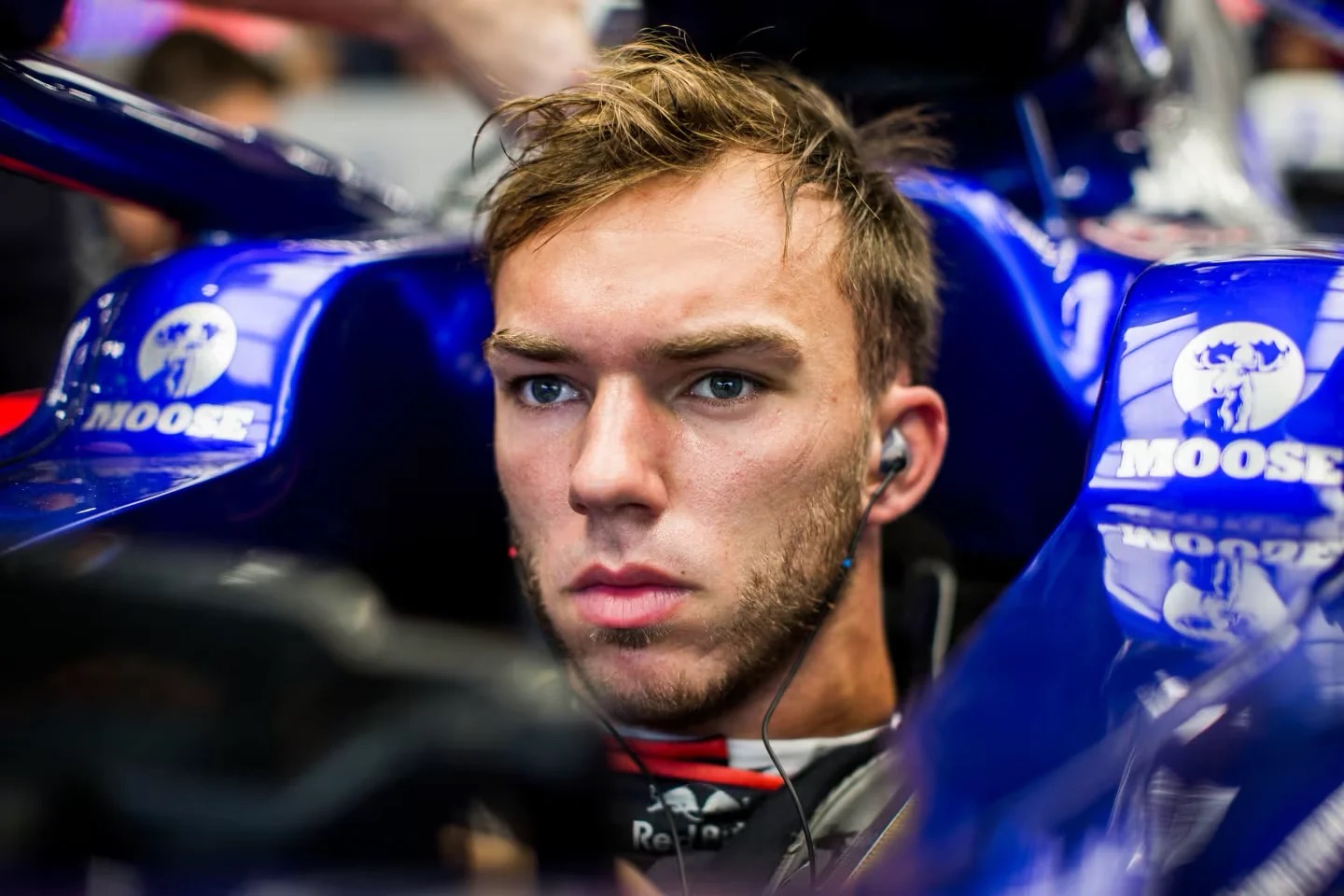 Pierre Gasly Hair Transplant: Did the F1 Star Really Get One?