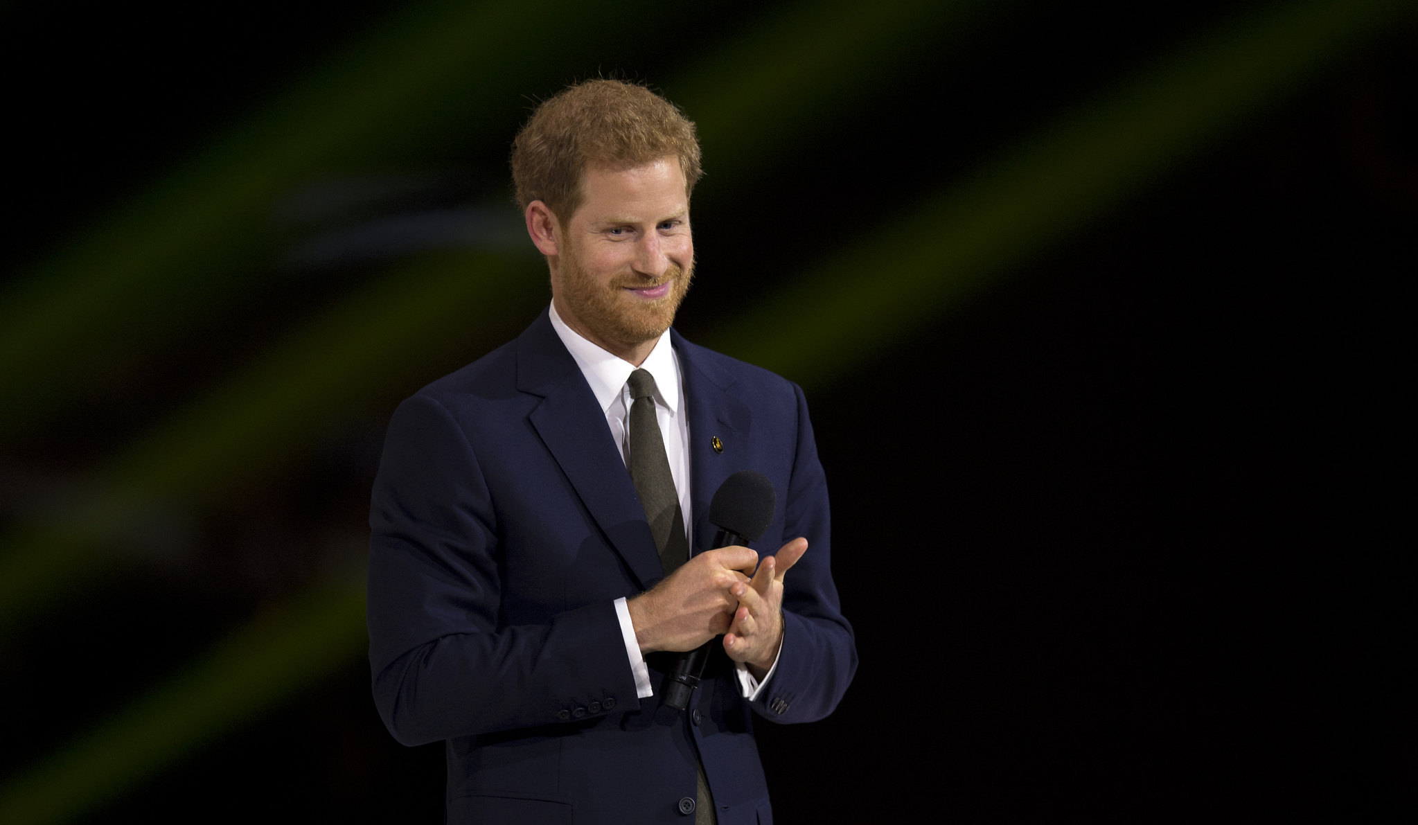 Prince Harry Hair Transplant